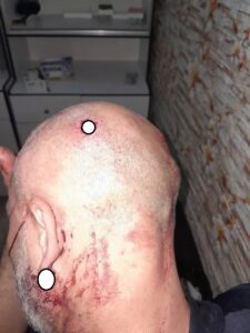 الاعتداء على المواطن حازم سلامة من الطائفة العلوية في مساكن الديماس