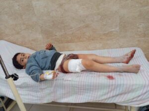 توثيق مجزرة قرية خراب عشك بريف كوباني: مقتل خمسة أفراد من عائلة كردية، بينهم طفلان، وإصابة مدنيين آخرين جراء قصف استهدف منازلهم