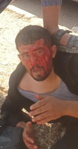 اعتداء على شاب كردي من مهجّري سري كانيه بعد عودته إلى مدينته ضمن قافلة العودة