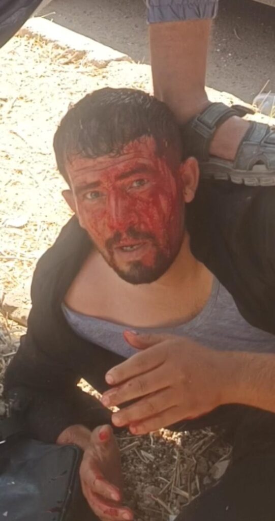 اعتداء على شاب كردي من مهجّري سري كانيه بعد عودته إلى مدينته ضمن قافلة العودة